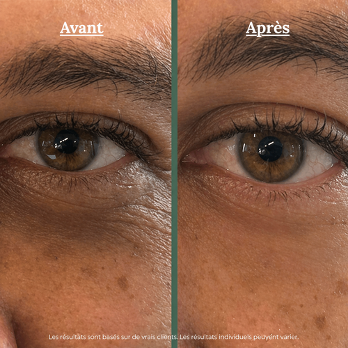 SSF™ – Patchs Yeux Peptides & Collagène