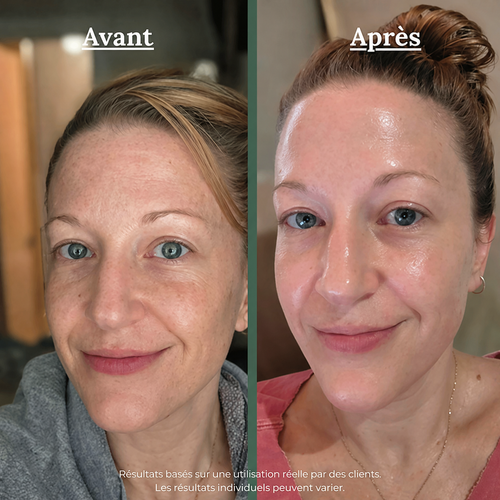 SSF™ – Patchs Yeux Peptides & Collagène